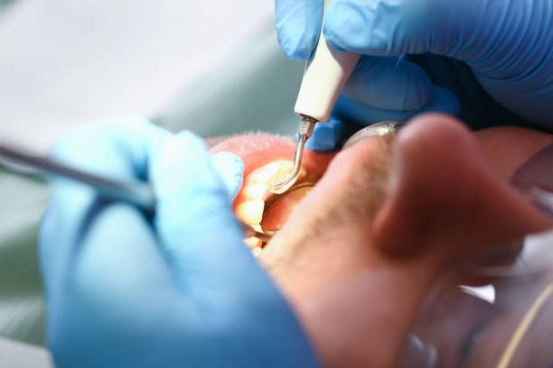 Best Orthodontic Emergency Dentist in Magnolia, NC