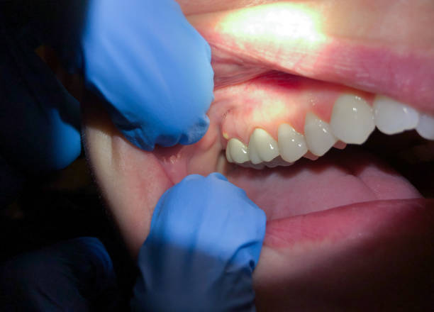 Best Broken or Cracked Tooth Emergency Dentist in Magnolia, NC