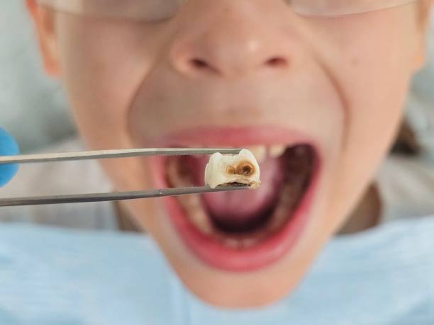 Best Broken or Cracked Tooth Emergency Dentist in Magnolia, NC